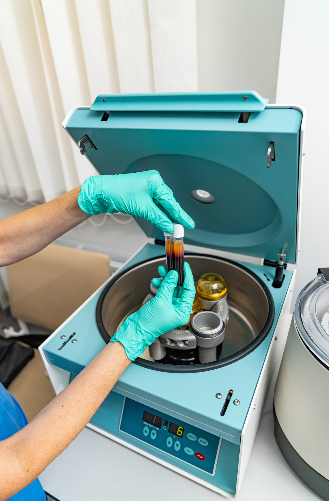 Plasma platelet rich centrifuge preparation. Biochemistry plasma experiment.